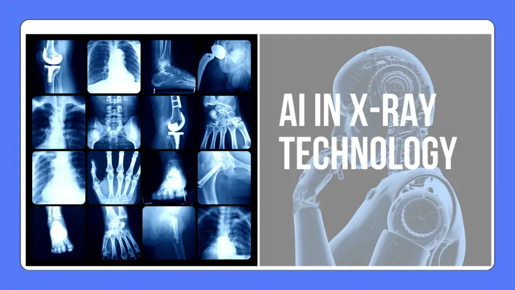 AI In X Ray Technology Can AI Replace Rad Techs