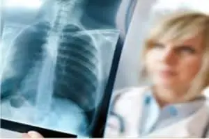 x ray tech school image