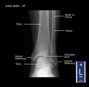 Student Study Guide: Ankle Anatomy