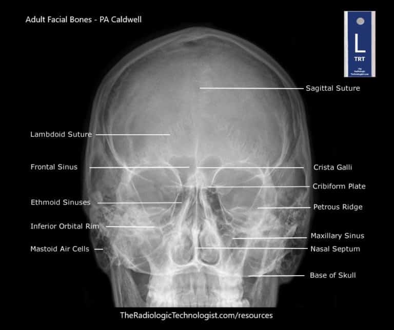 only movable bone in the facial skeleton