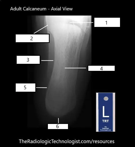 Blank - Adult Calcaneum - Axial View (1)