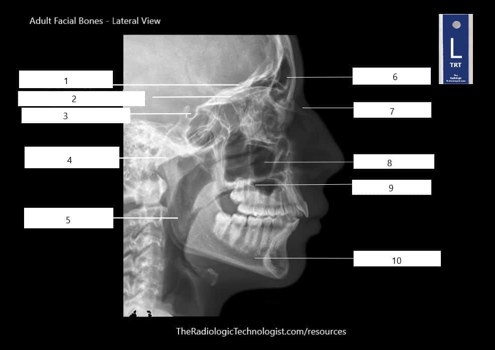 Student Study Guide: Facial Bones Anatomy