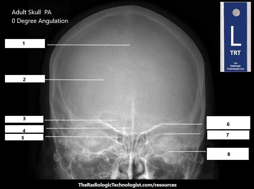 Blank - Adult Skull - PA 0 Degree Angulation
