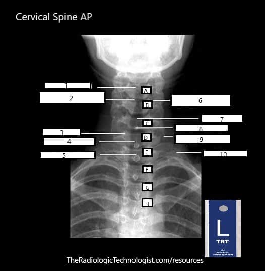 Blank - Cervical-Spine-AP-Radiologic-Technologist-Anatomy