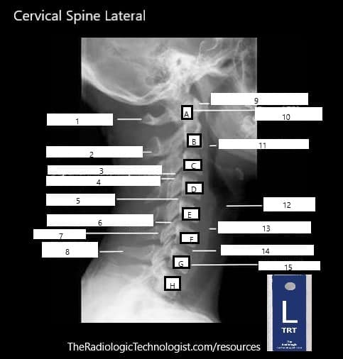 Blank - Cervical-Spine-Lateral-Radiologic-Technologist-Anatomy
