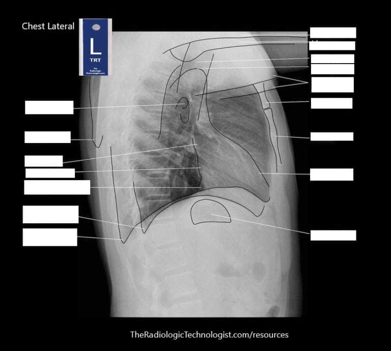 Student Study Guides: Chest Anatomy