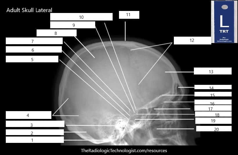 Blank - Skull-Lateral-Radiologic-Technologist-Anatomy