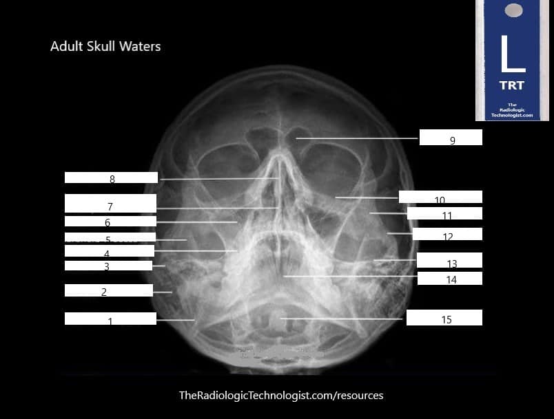 Blank - Skull-Waters-Radiologic-Technologist-Anatomy (1)