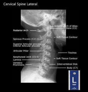 Student Study Guide: Cervical Spine Anatomy