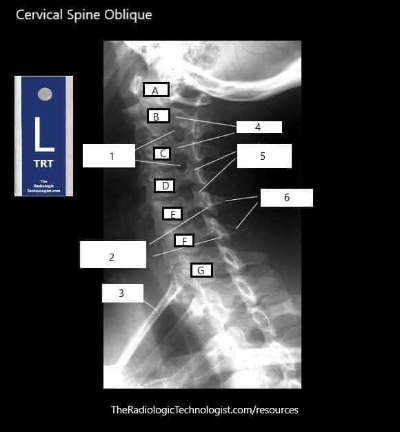 Cervical-Spine-Oblique-Radiologic-Technologist-Anatomy