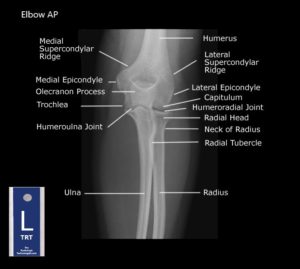 Student Study Guide: Elbow Anatomy