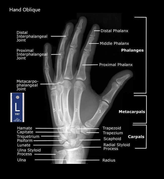 Hand-Oblique-Radiologic-Technologist-Anatomy