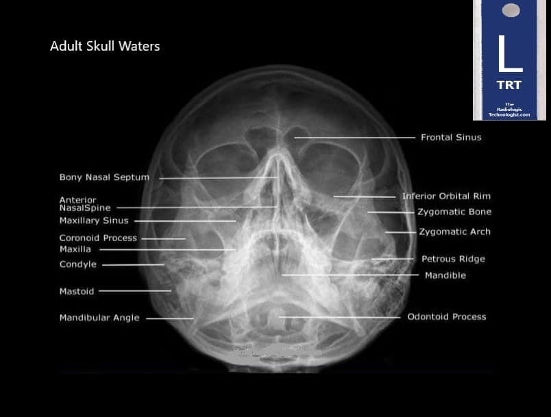 Skull-Waters-Radiologic-Technologist-Anatomy (2)