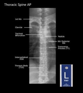 Student Study Guides: Thoracic Spine Anatomy