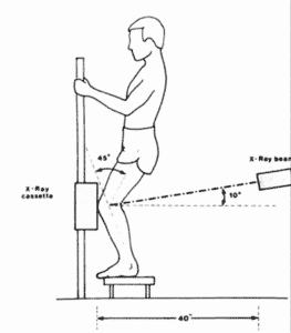 normal-knee-xray-rosenberg