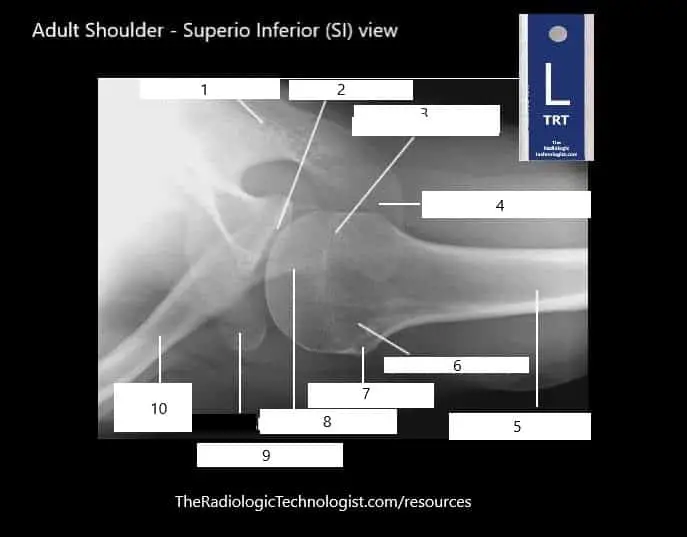 Blank - Adult-Shoulder-Superio-Inferior-SI-view-1