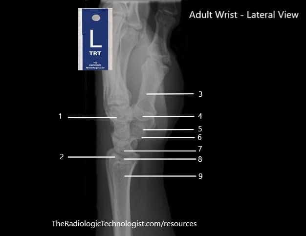 Blank - Adult-Wrist-Lateral-View-1