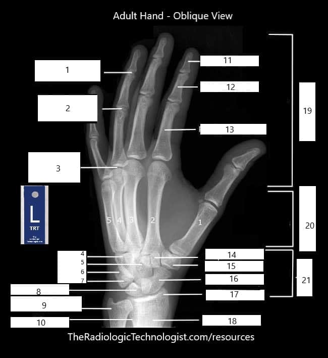 Blank - Hand-Oblique-Radiologic-Technologist-Anatomy