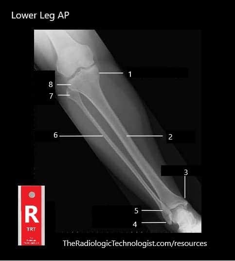 Blank - Lower-Leg-AP-Radiologic-Technologist-Anatomy