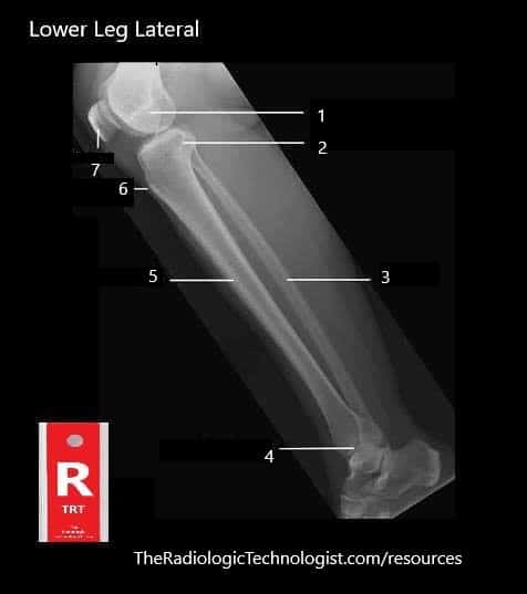 Blank - Lower-Leg-Lateral-Radiologic-Technologist-Anatomy
