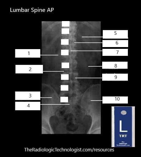 Blank - Lumbar-Spine-AP-Radiologic-Technologist-Anatomy