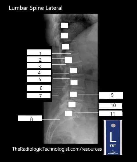 Blank - Lumbar-Spine-Lateral-Radiologic-Technologist-Anatomy (1)