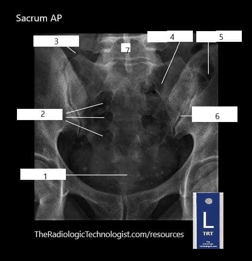 Blank - Sacrum-AP-Radiologic-Technologist-Anatomy