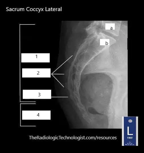Blank - Sacrum-Coccyx-Lateral-Radiologic-Technologist-Anatomy (1)