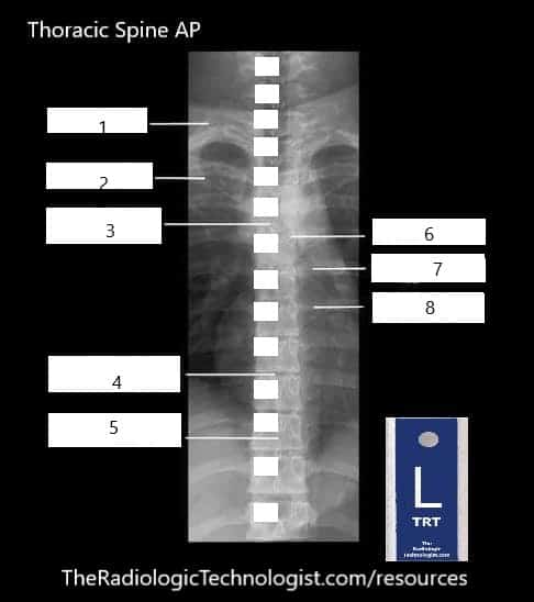 Blank - Thoracic-Spine-AP-Radiologic-Technologist-Anatomy