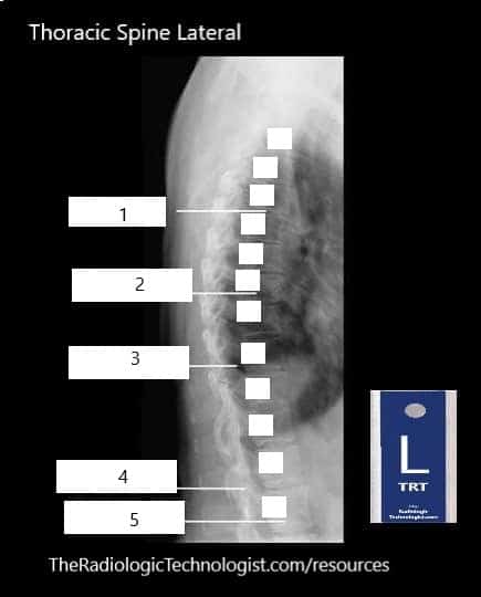 Blank - Thoracic-Spine-Lateral-Radiologic-Technologist-Anatomy