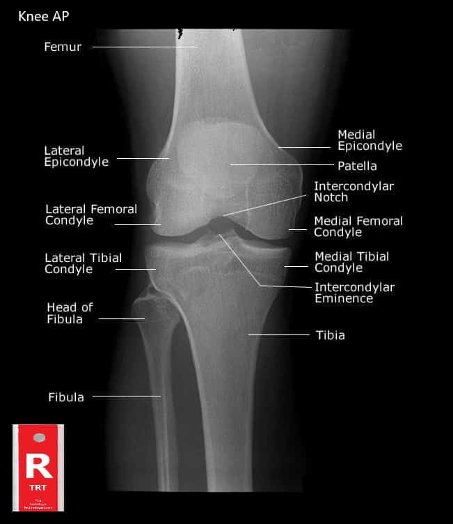 normal knee xray 