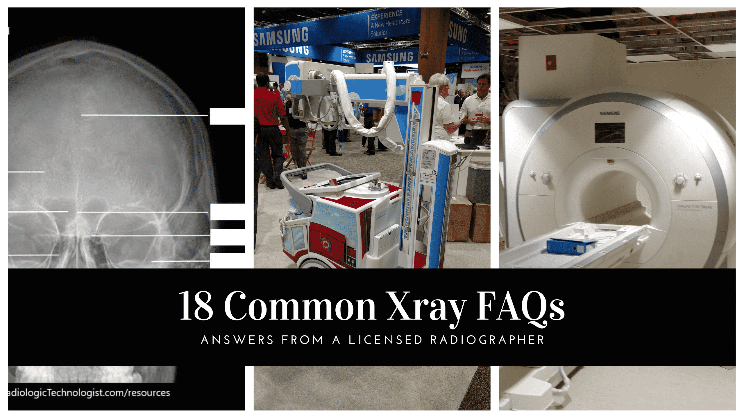18 Common Xray FAQs