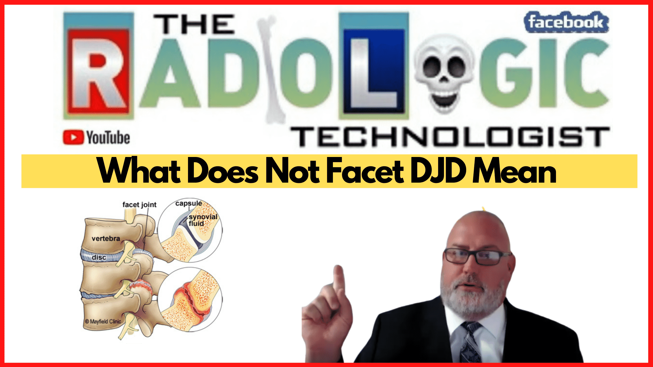 What Does Not Facet DJD Mean on Radiology Report?