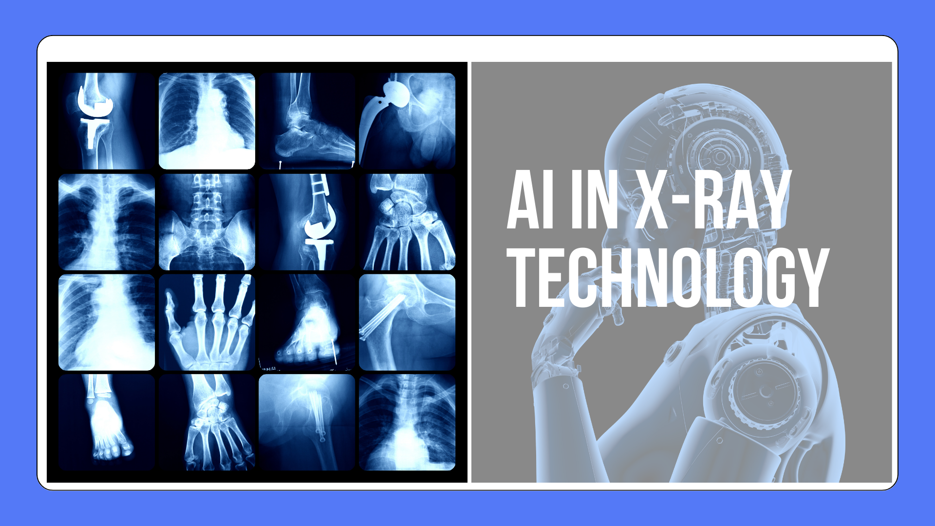 AI in X-Ray Technology