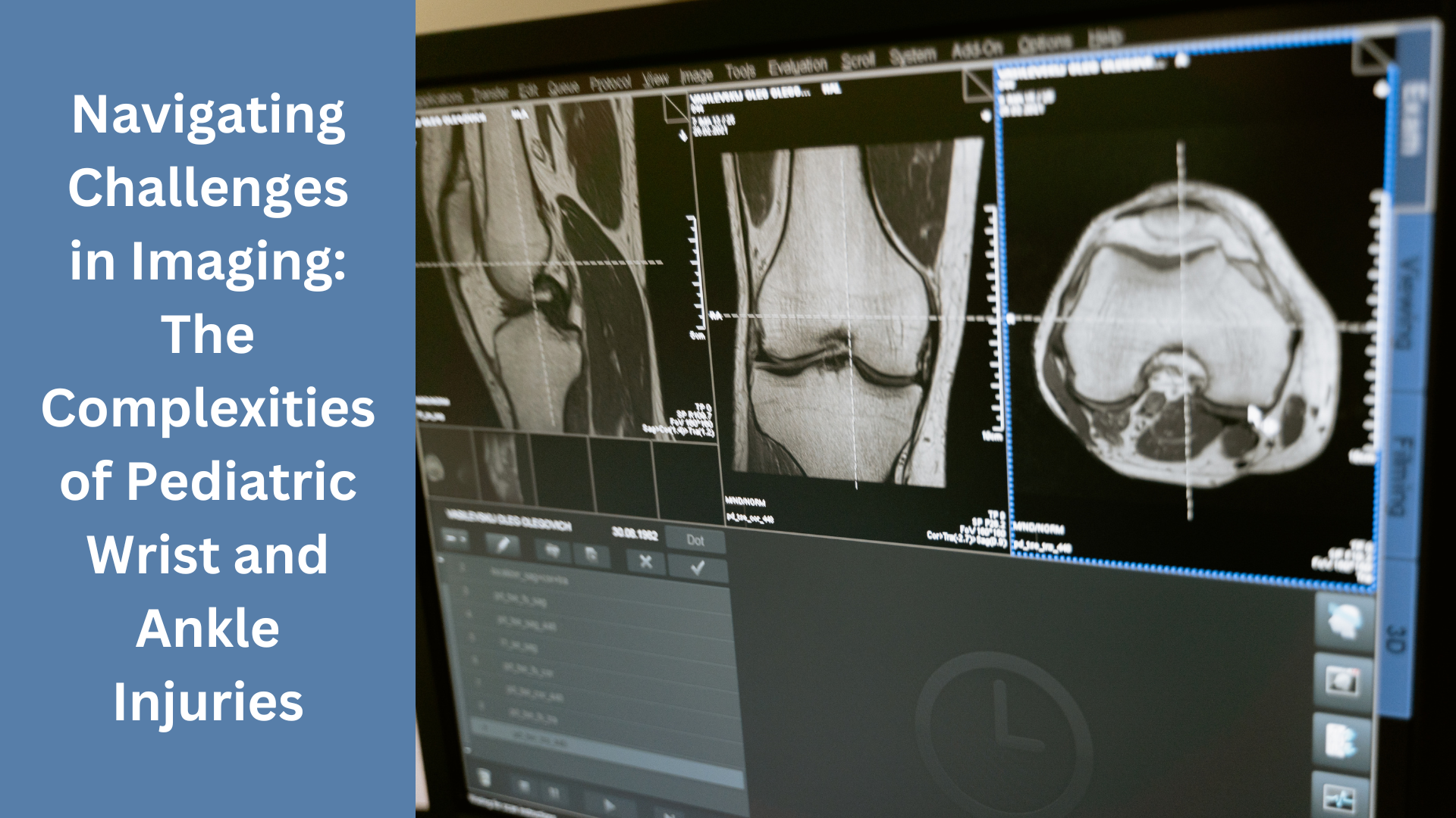 Navigating Challenges in Imaging: The Complexities of Pediatric Wrist and Ankle Injuries