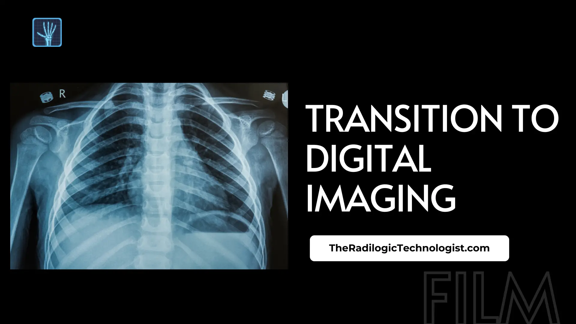 Transition to Digital Imaging: Perspectives of X-ray Technologists
