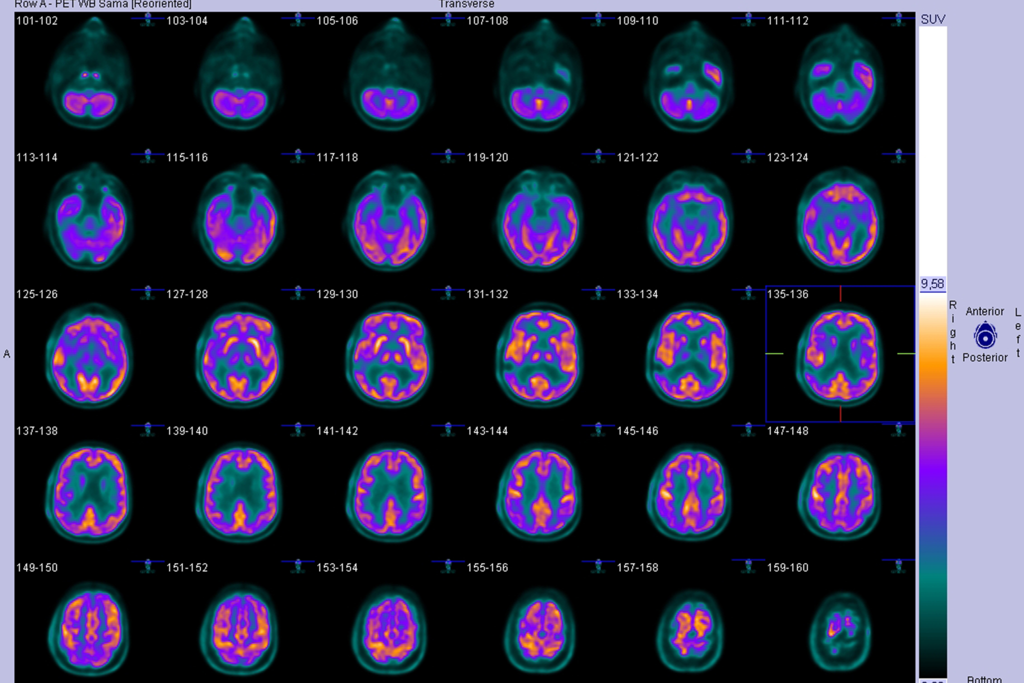 Ap Axial Towne And Pa Axial Haas Methods In Skull Radiography