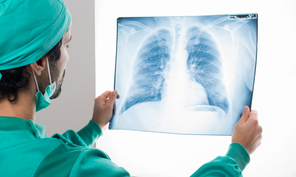 Protecting X-ray Techs in Mobile Radiography: Essential Safety Measures