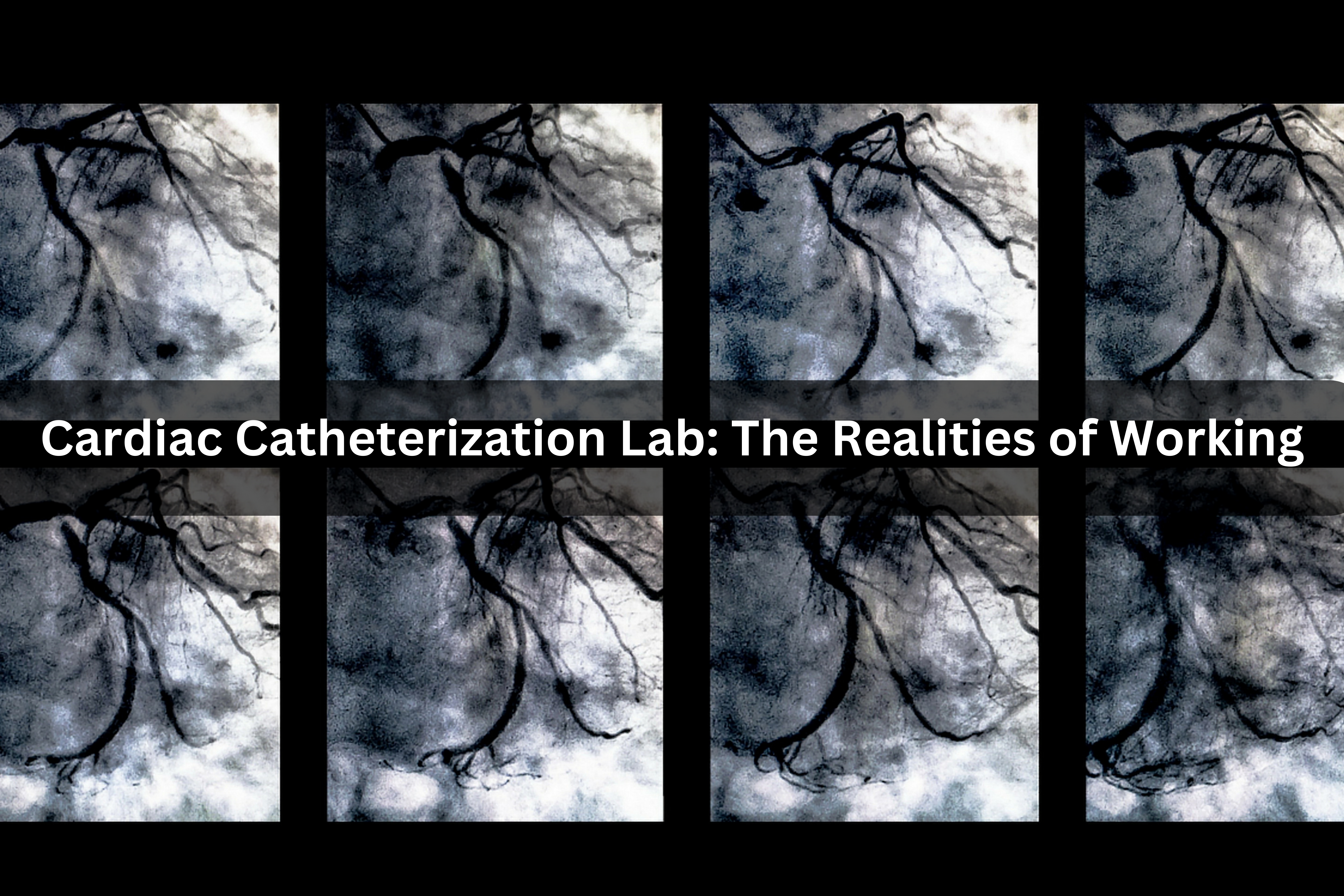 Cardiac Catheterization Lab: The Realities of Working