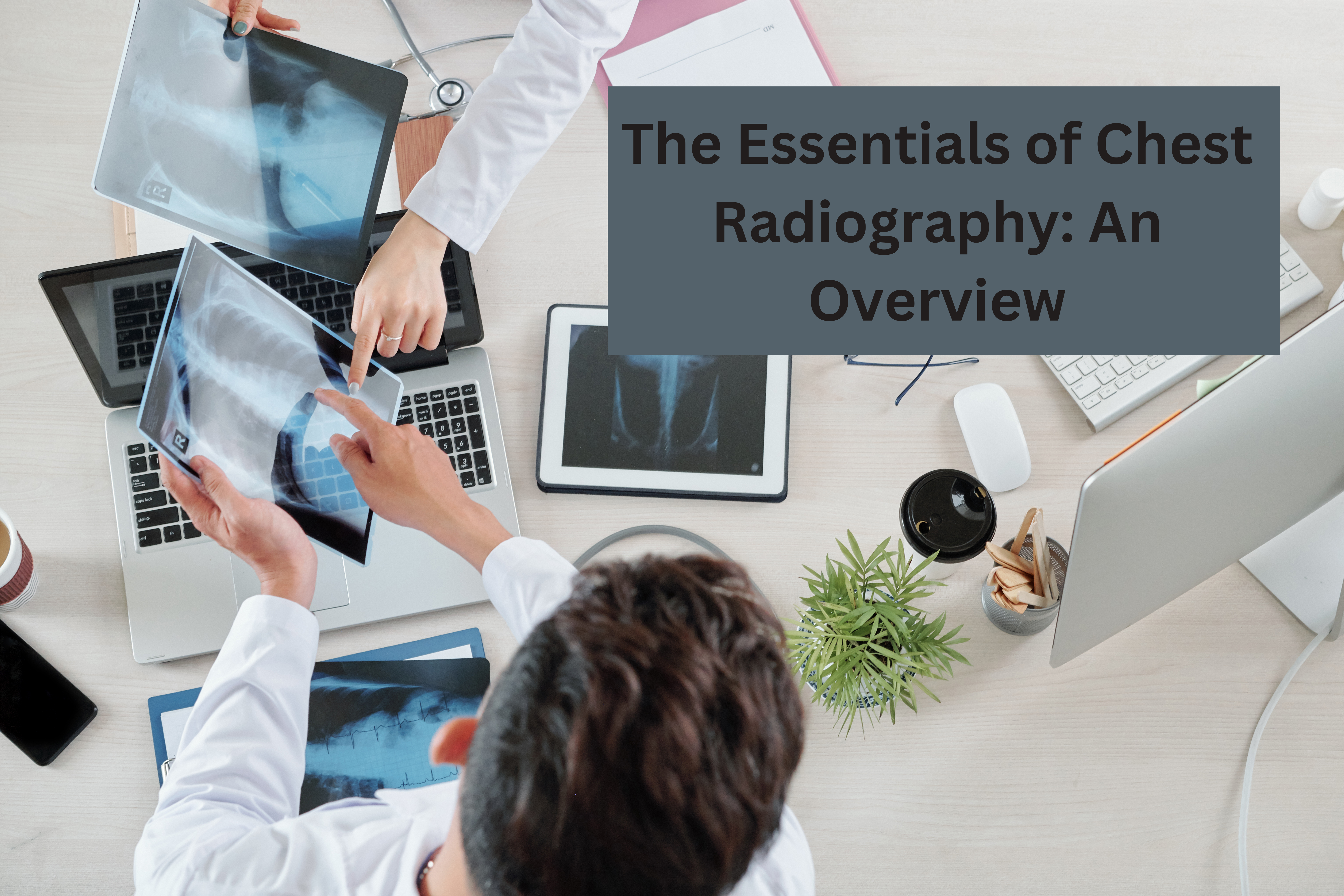 essentials of chest radiography