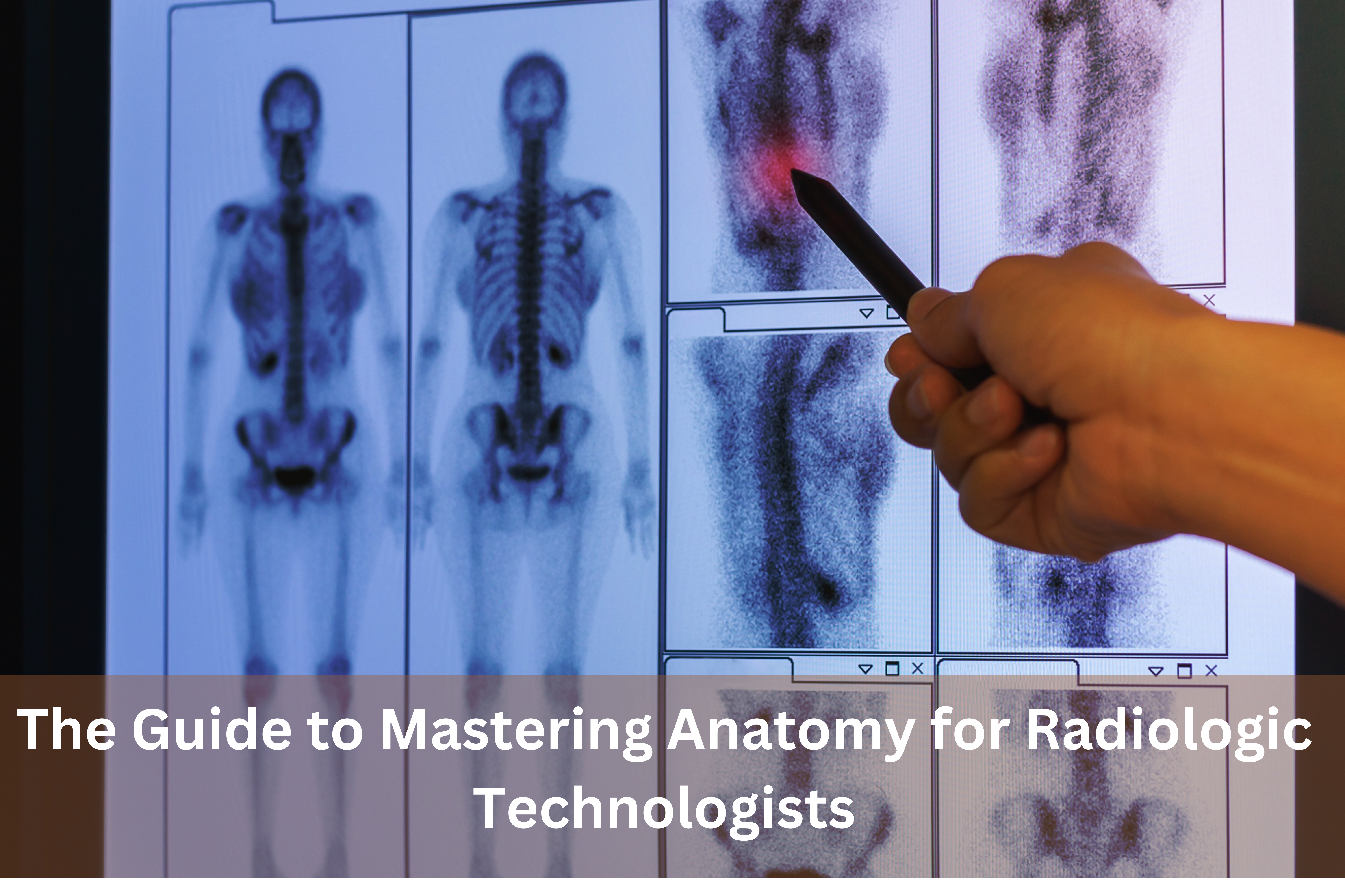 The Guide to Mastering Anatomy for Radiologic Technologists