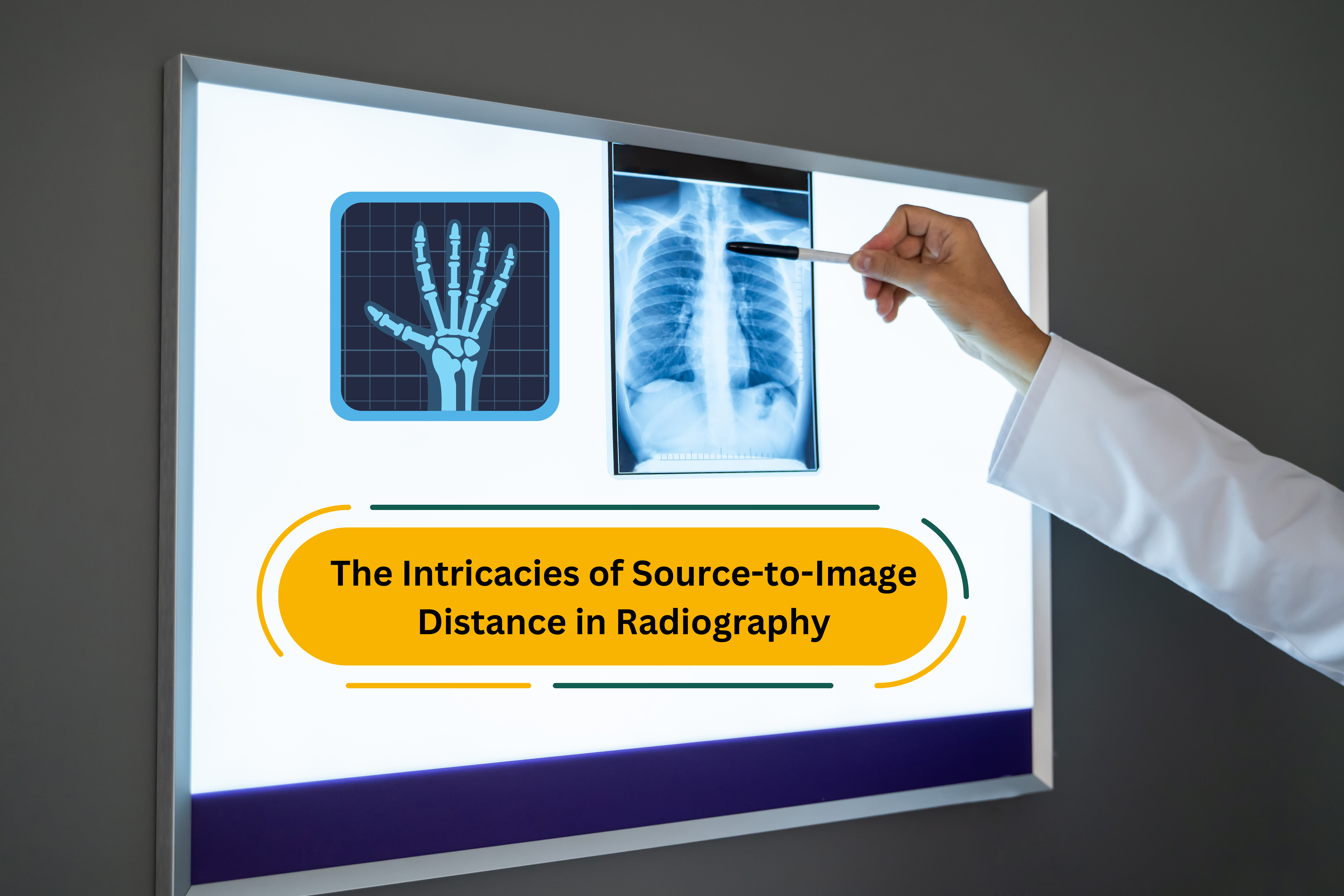 Source-to-Image Distance