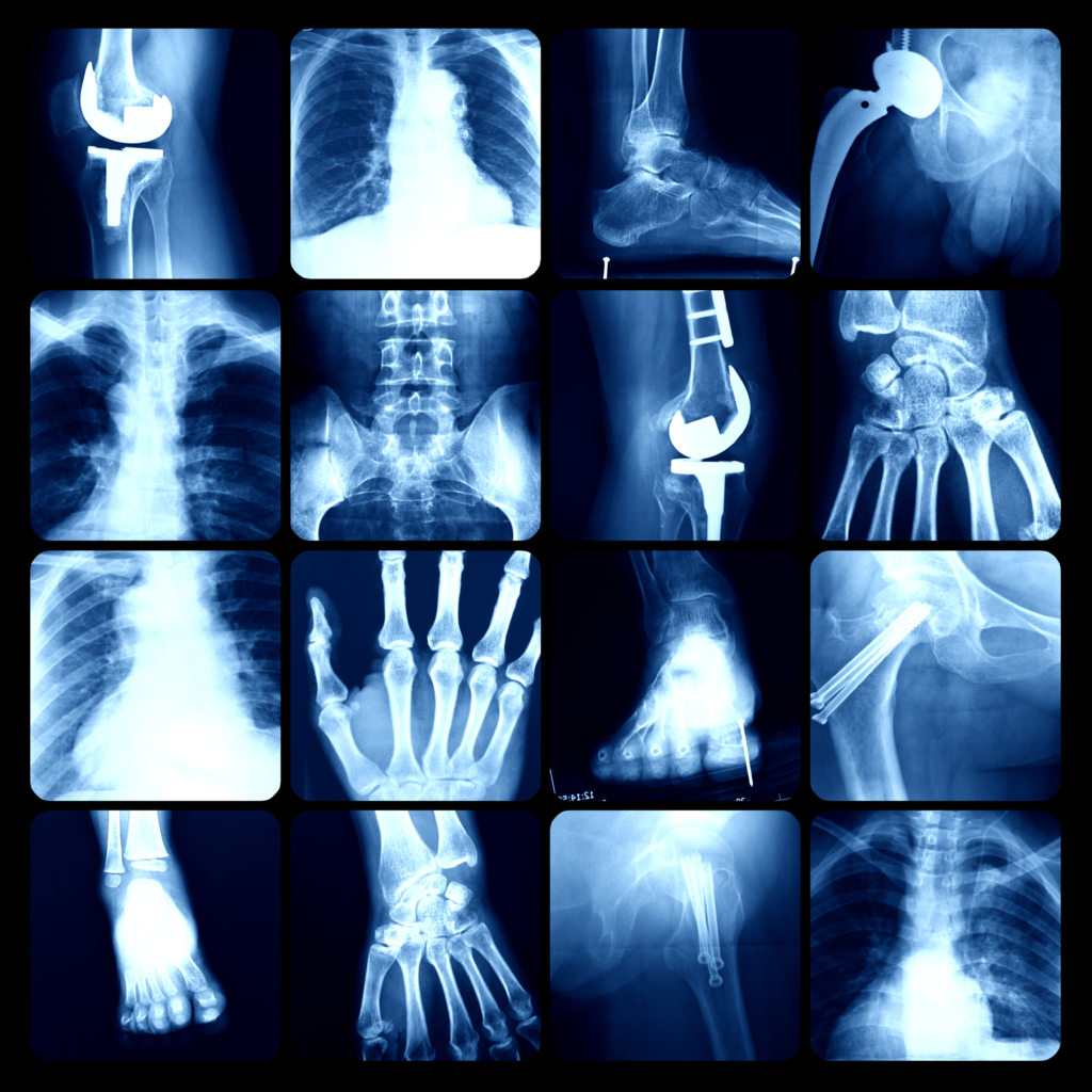 X-ray Technology