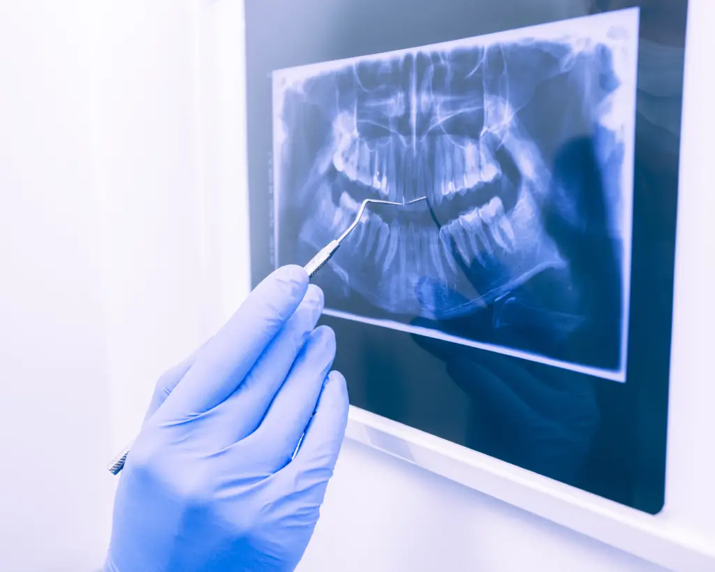 Delta Dental Xray